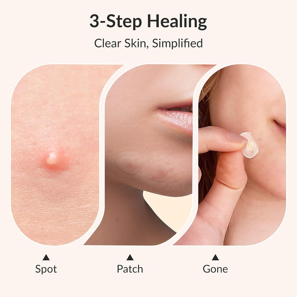 Clear Patch